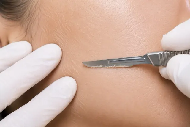 Dermaplane Facial