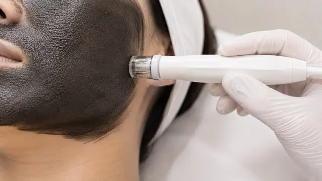 Carbon Facial