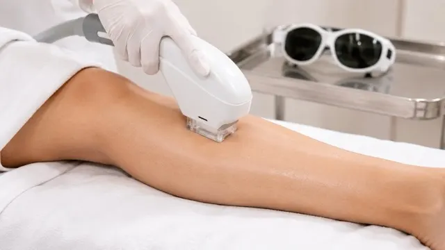 Laser Hair Removal