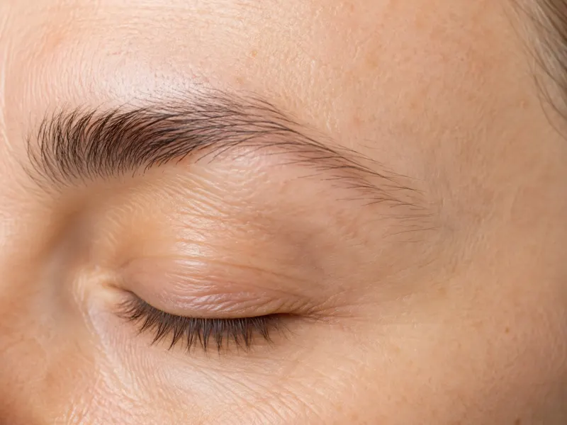 Brow Volume