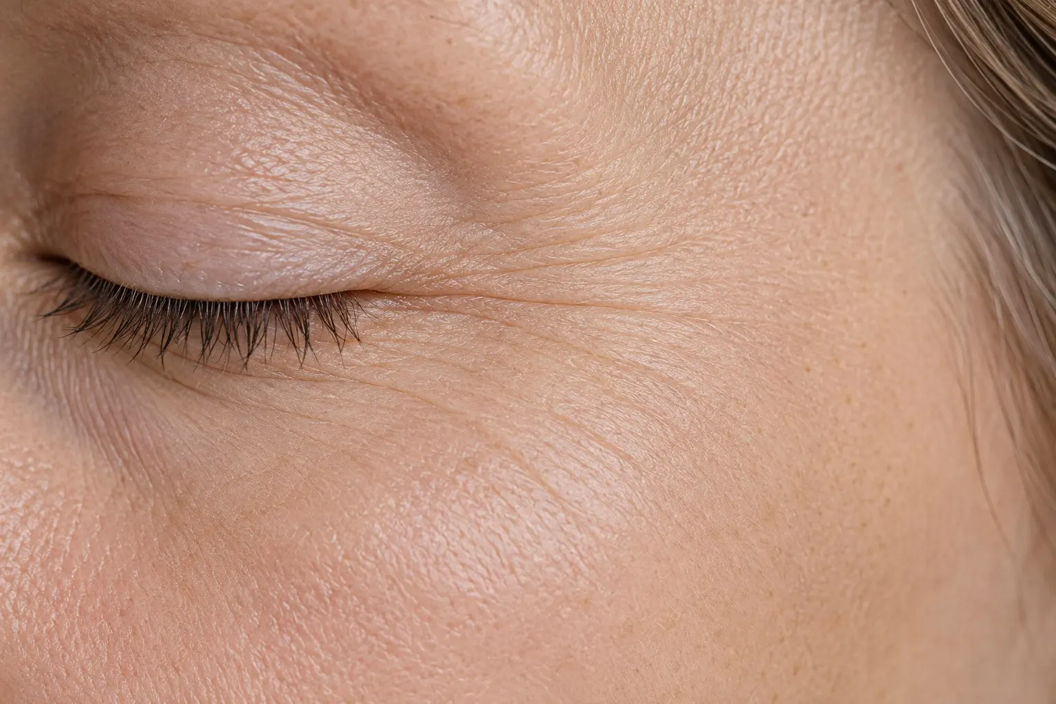 Fine Lines & Wrinkles