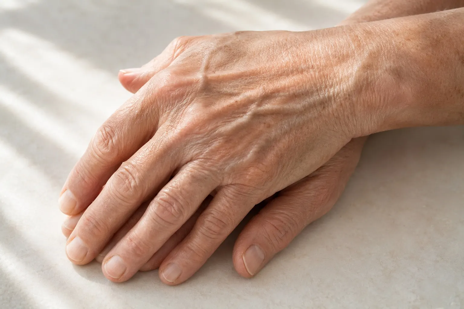 Hand Rejuvenation